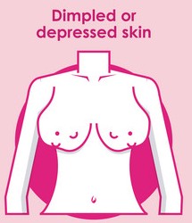 Dimpled Breast